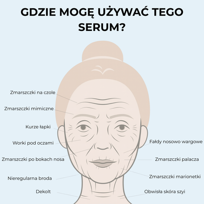 System Mikroinfuzji PDRN