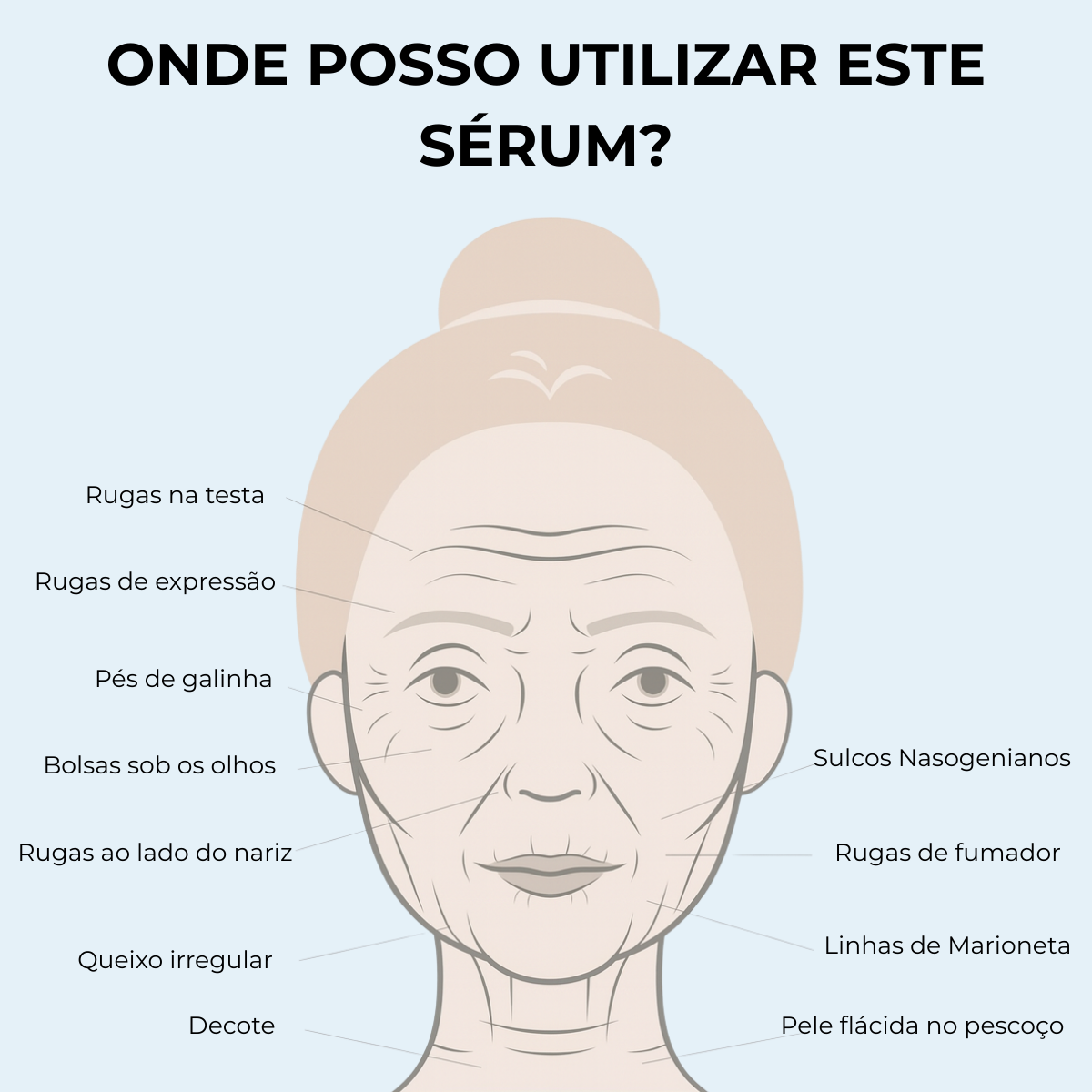Sistema de Microinfusão PDRN