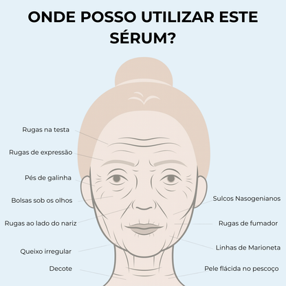 Sistema de Microinfusão PDRN